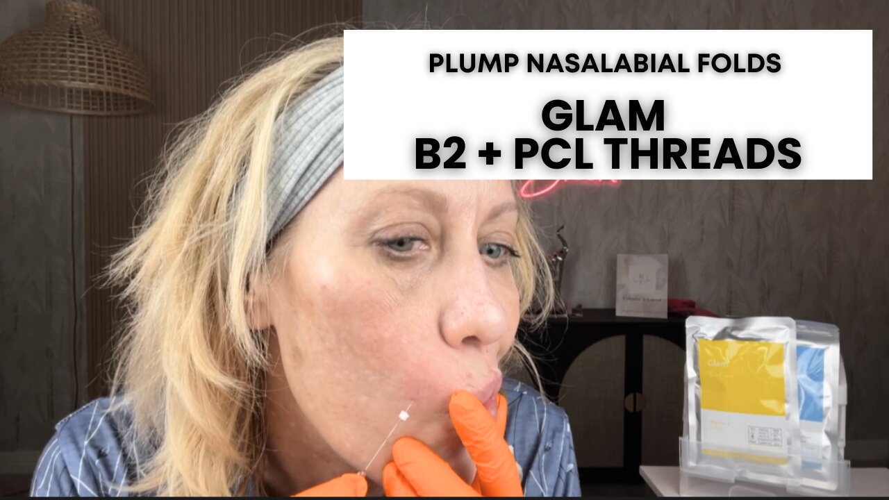 Plump Nasolabial Folds with Vitamin B2 + PCL Cannula Threads - Create More Collagen!