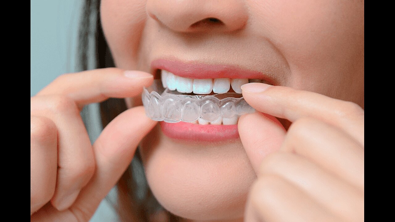 TYPES OF ORTHODONTIC TREATMENT