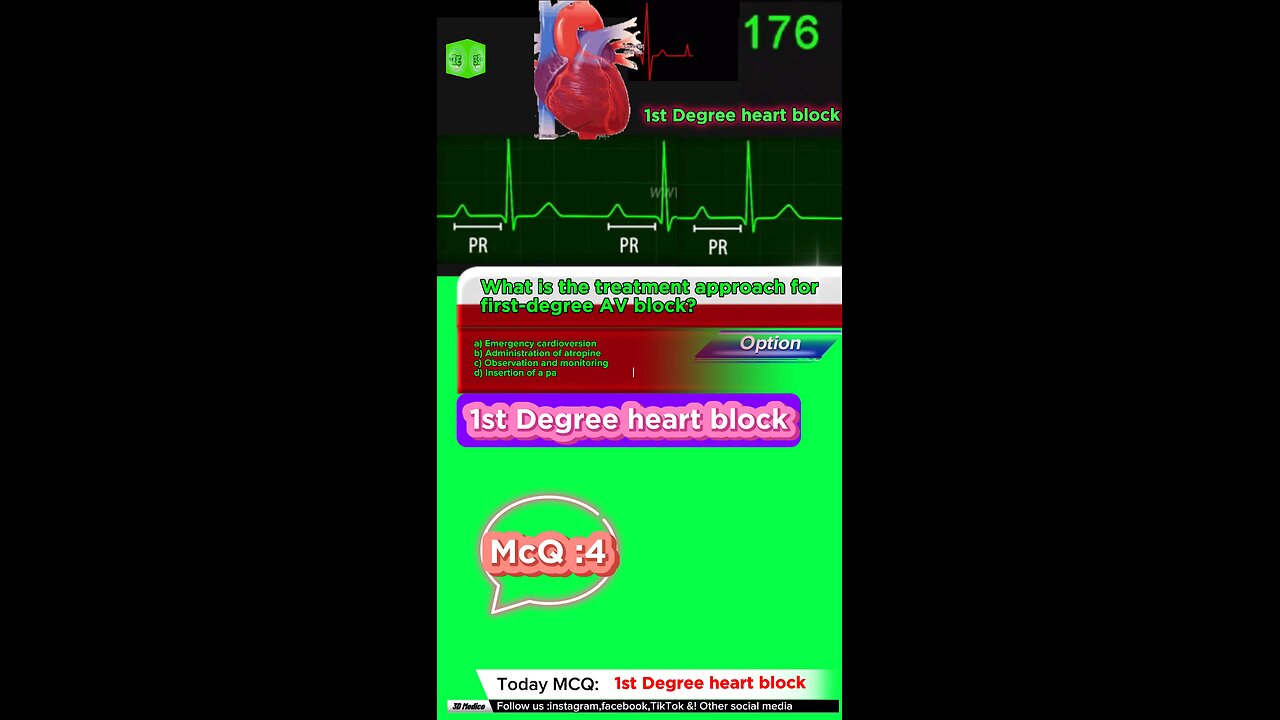 First degree heart blockages #firstdegreeavblock #arrthymias #CardiacArrhythmia #Cardiology