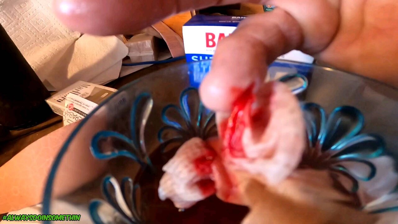 Ouch bandage got stuck