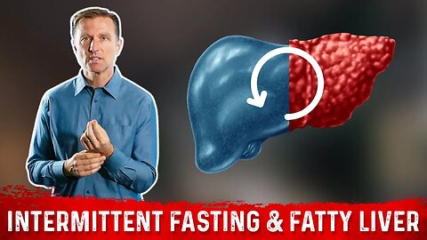 Can Intermittent Fasting Reverse a Fatty Liver? Fasting as Remedy for Fatty Liver – Dr. Berg