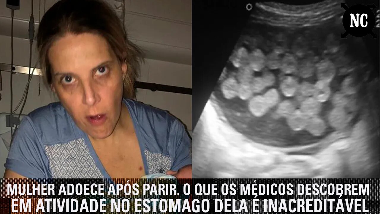 Mulher adoece após parir. O que os médicos descobrem em atividade no estômago dela é inacreditável