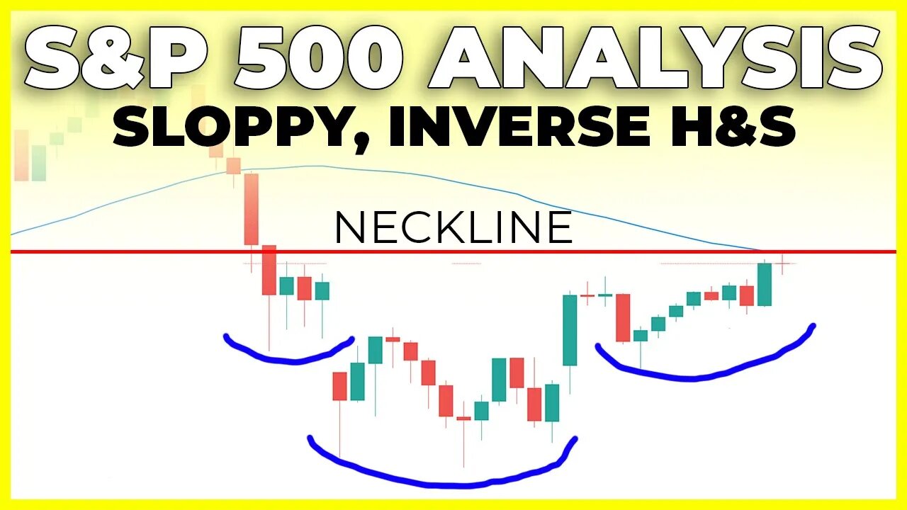 SP500 & JUST ABOUT EVERYTHING ELSE MOVES HIGHER (Watch These Levels) | S&P 500 Technical Analysis