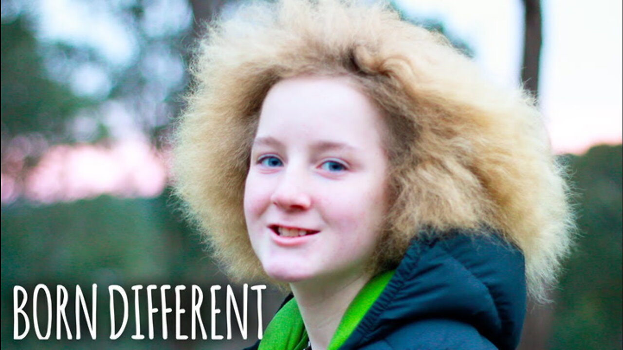 I Have Uncombable Hair Syndrome | BORN DIFFERENT