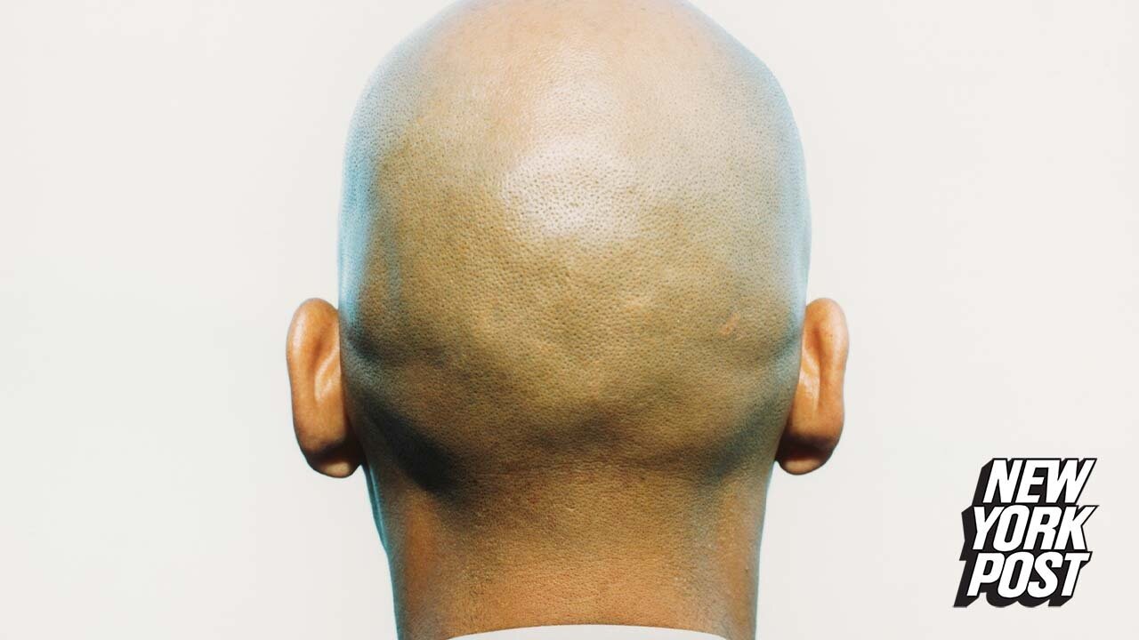 Calling men 'bald' counts as sexual harassment on the job, UK judges rule