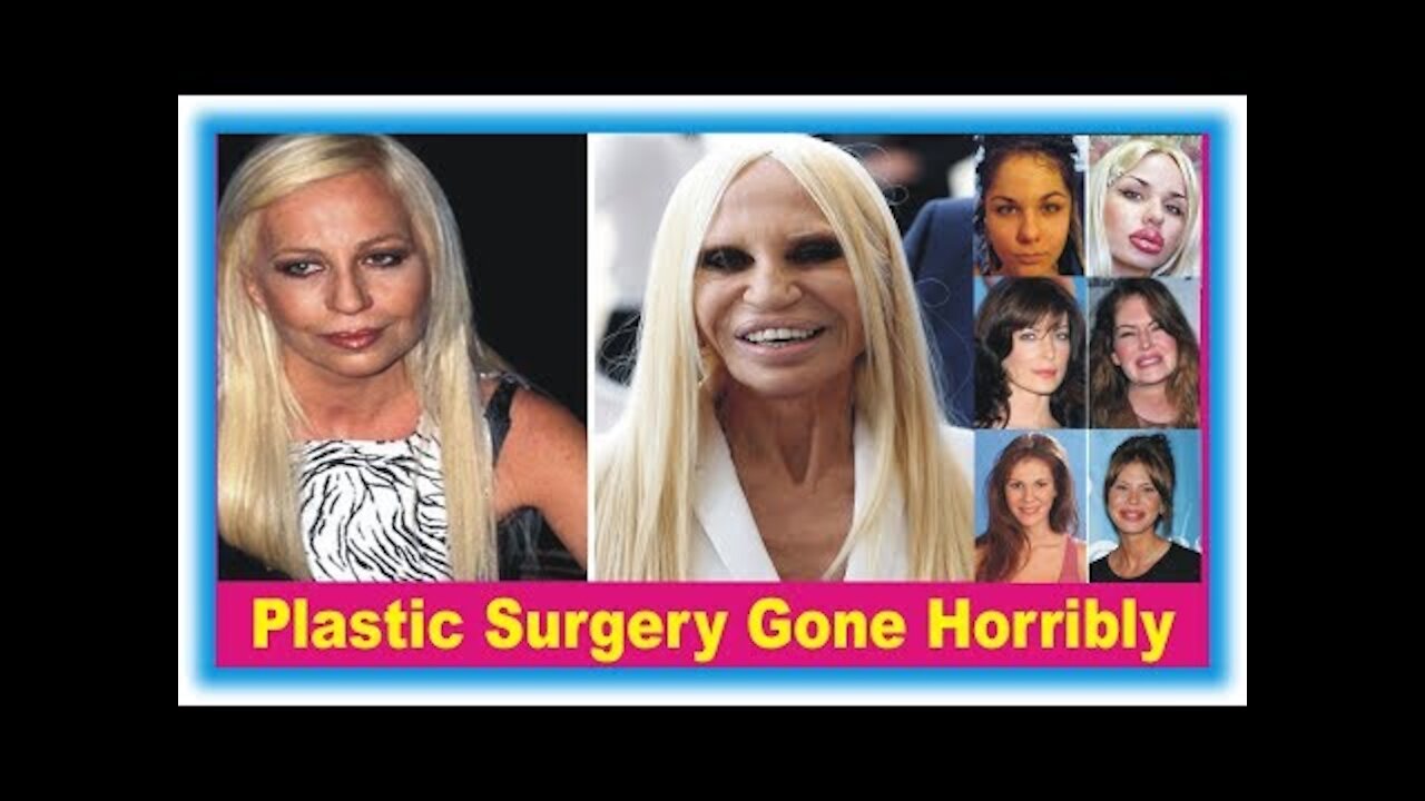 Plastic Surgery Gone Horribly Wrong Top 9 Worst Plastic Surgery