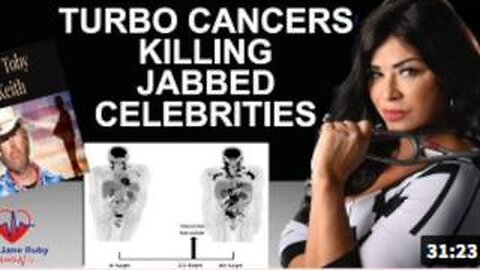 TURBO CANCERS ARE TAKING OUT JABBED CELEBRITIES