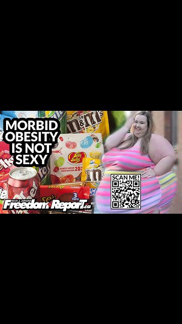 MORBID OBESITY IS NOT SEXY, NOT HEALTHY, AND NOT TO BE CELEBRATED - THE LEFT IS NUTS!