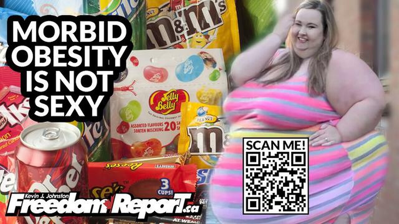 MORBID OBESITY IS NOT SEXY, NOT HEALTHY, AND NOT TO BE CELEBRATED - THE LEFT IS NUTS!