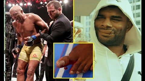 Best KO's ** Worst Injuries in UFC History ** Broken bones