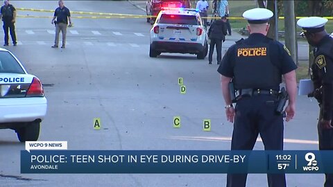 Teen shot in eye during drive-by in Avondale