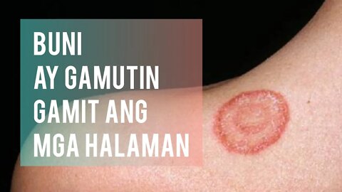 HALAMANG GAMOT PARA SA BUNI