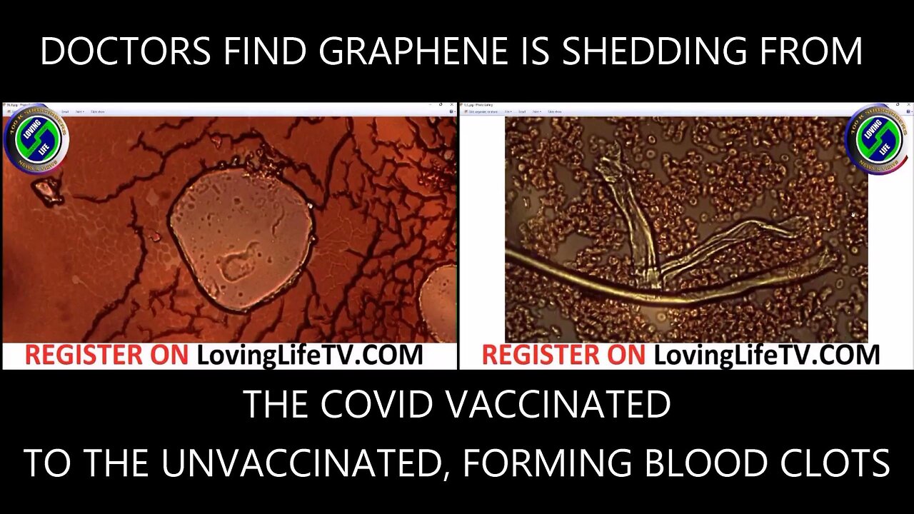 DOCTORS FIND GRAPHENE IS SHEDDING FROM THE COVID VACCINATED TO THE UNVACCINATED, FORMING BLOOD CLOTS