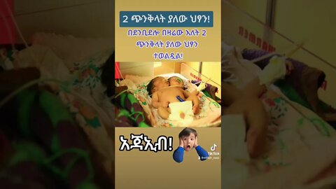 ሁለት ጭንቅላት ያለው ህፃን ነሀሴ 5/2014 ደንቢዶሎ #fetadaily #eregnaye #seifuonebs #ethiopian #ተዋወቋት