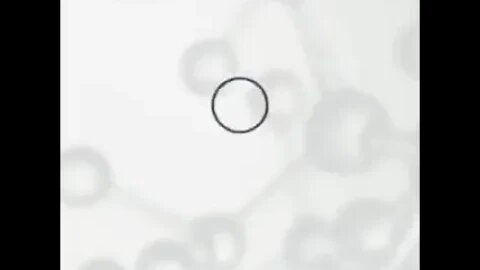 Reason #1 To Filter Your Water!