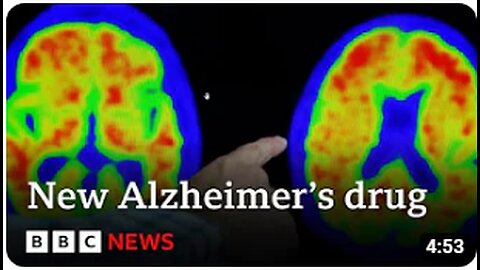 New drug brings hope to end Alzheimer's - BBC News