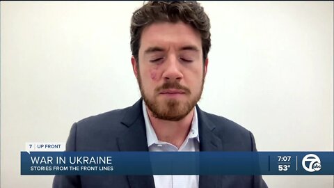 Examining the recent revelations about the war in Ukraine