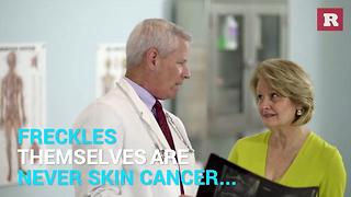 Facts About Your Freckles | Rare Life