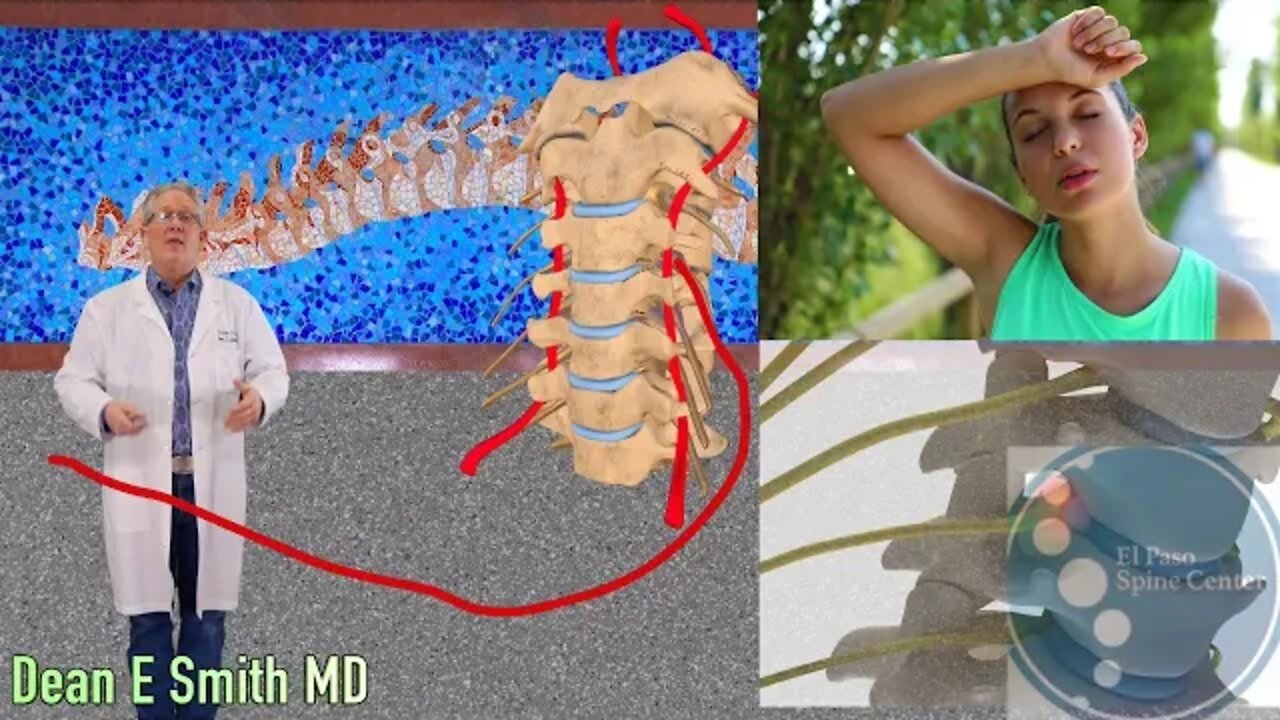 Are You A Candidate for an Artificial Cervical Disc ?