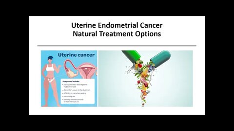 Uterine Endometrial Cancer - Natural Treatment Options