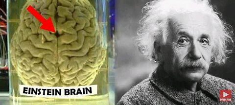 How Einstein's brain was different