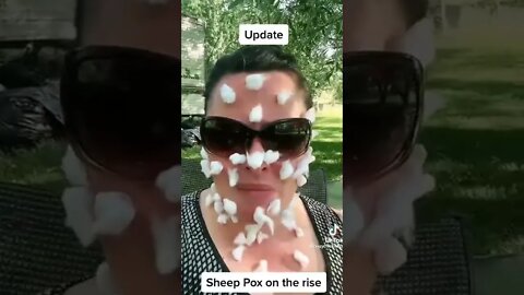 The sheep pox 🐑🦠🤡😂😂