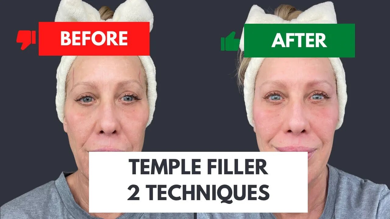 Temple Restoration using Two Techniques