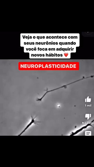 O que é uma neuroplasticidade?