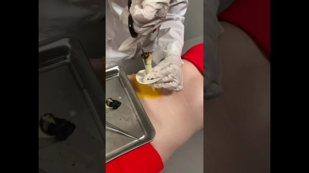 They used a egg to clean out her belly button…