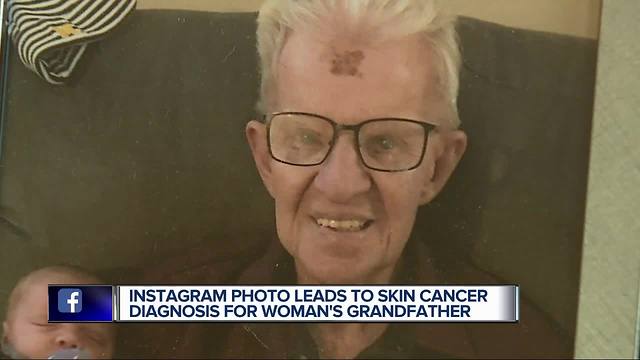 Metro Detroit doctor spots cancer from Instagram photo, possibly saving man's life