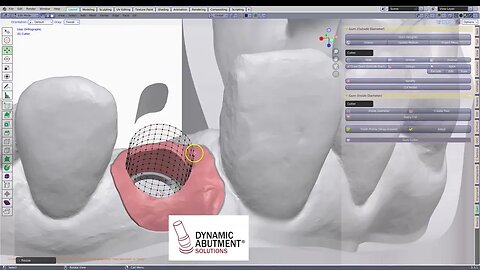 Dynamic Abutments