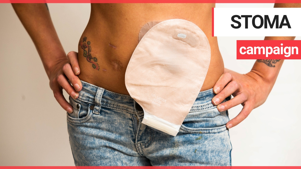 Mum embarks on mission to show people living with stomas don’t smell