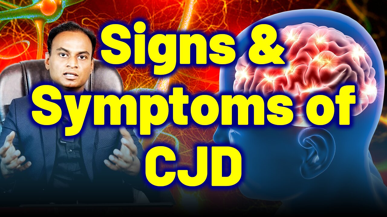 Signs and Symptoms of CJD or Prions Disease . | Dr. Bharadwaz | Homeopathy, Medicine & Surgery