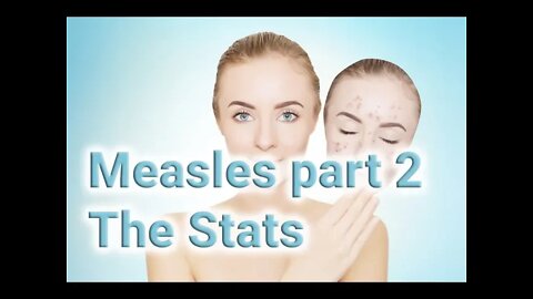 Measles Part 2 - The Stats