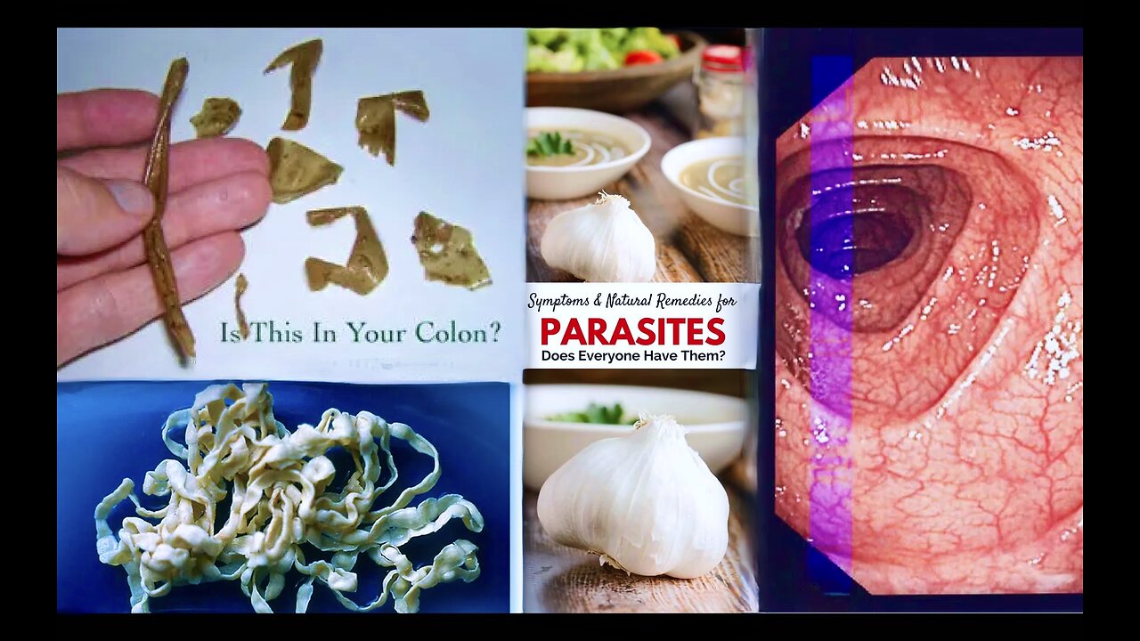 TikTok Chimerica USA Deworming How To Keep Your Colon Clean With Garlic Barbara ONeill Worm Detox