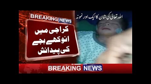 Birth of a unique baby in a private hospital of Karachi ||Sahar Tech Online #SAHARTECHONLINE