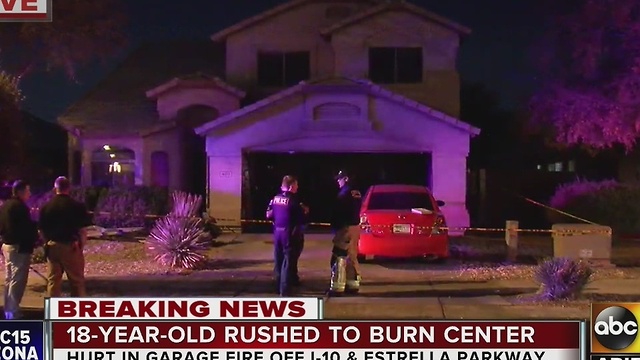 18-year-old taken to burn center after garage catches on fire