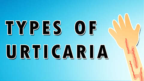 Urticaria Types - Cold Urticaria, Pressure Urticaria, and Aquagenic Urticaria