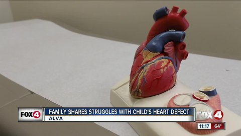 Family shares struggles with child's heart defect