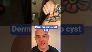 Derm reacts to FLYING cyst pop