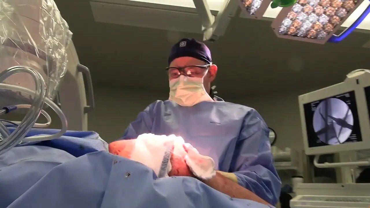 Hardware removal - Scott A. Barbour, M.D.