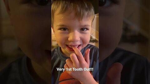 Ippi Lost His 1st Tooth!!! *so cute*