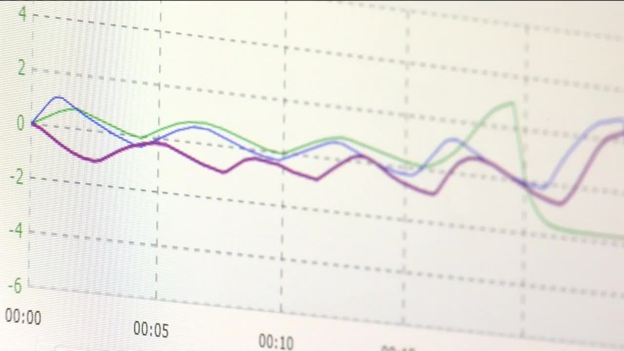 Researchers explore COVID-19's lingering symptoms