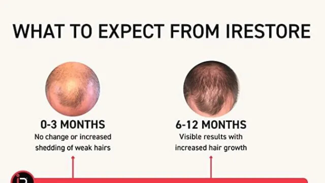 iRestore Essential Laser Hair Growth System - FDA Cleared Hair Growth for Men & Hair Loss Treatments