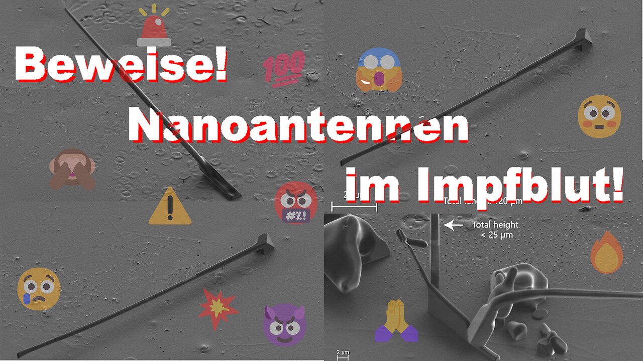 Beweise: Nanoantennen im Blut der GeimpftenβοΈπ―π₯π₯ππ±π³πππ€¬π’π’π’π€‘β οΈβ οΈβ οΈπ¨β οΈπ±