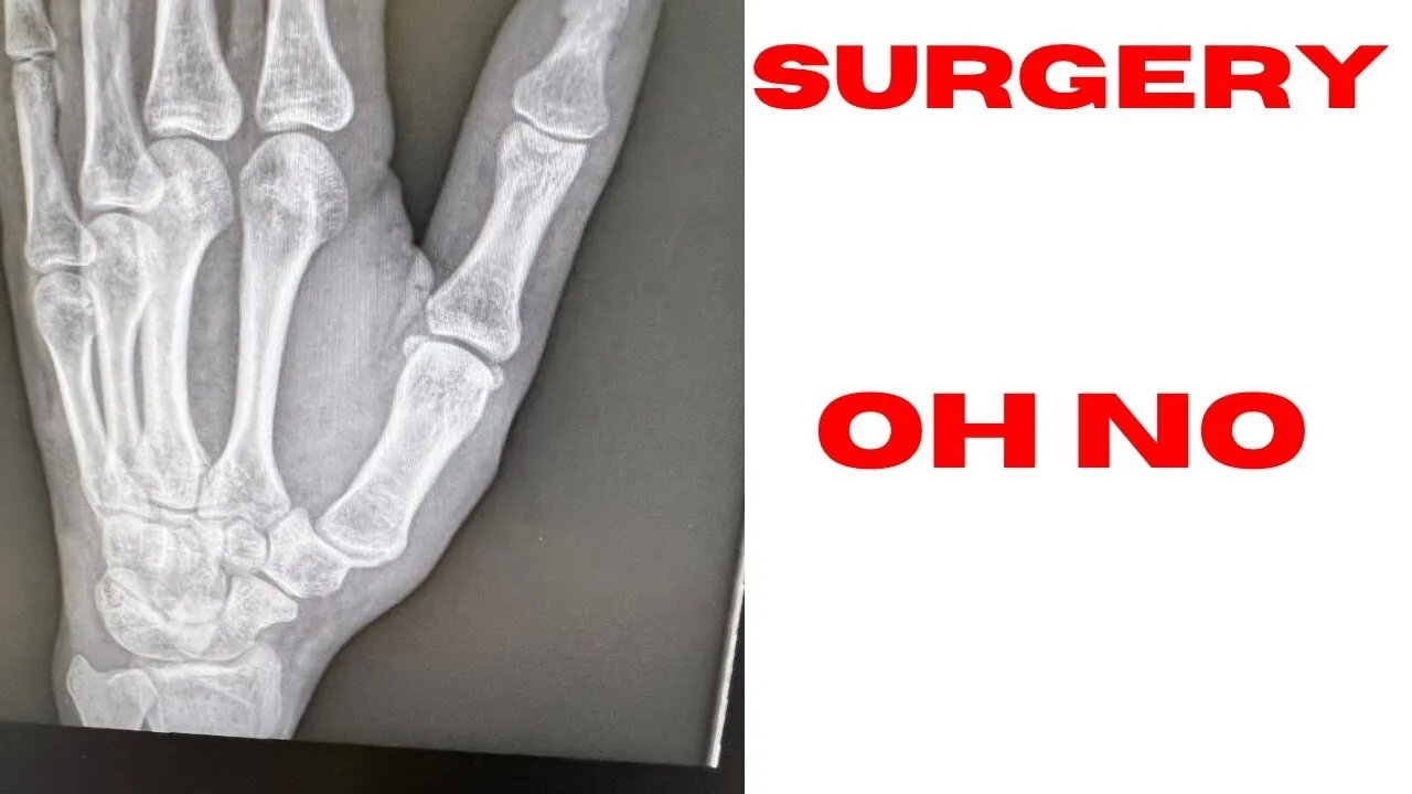 Going in for a tiny #surgery