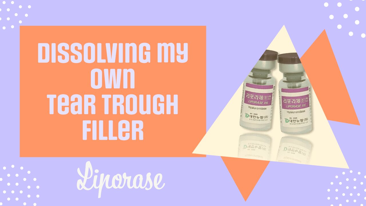 Dissolving my own Tear Trough Filler - Under Eyes - Hyaluronidase