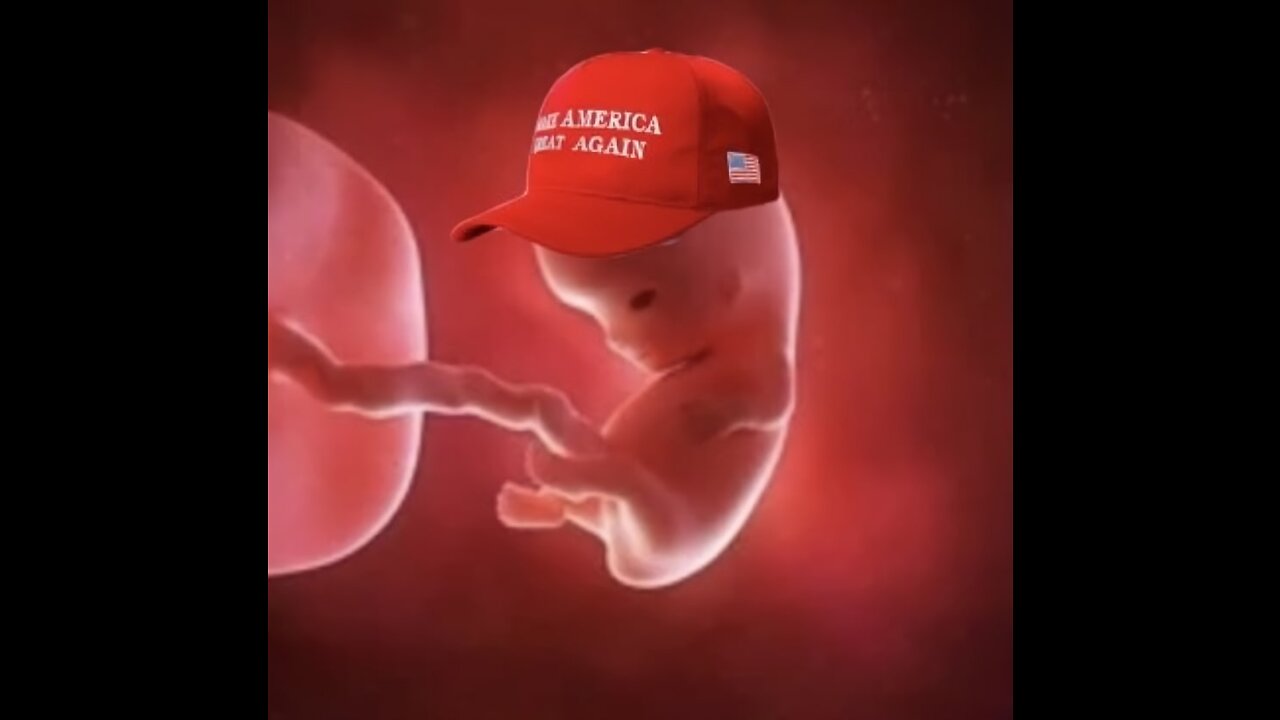 MY REAL THOUGHTS ON ABORTION #AlexStein