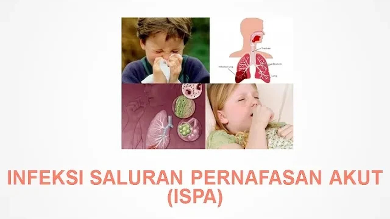 Infeksi Saluran Pernapasan Akut (ISPA) Acute Respiratory infections