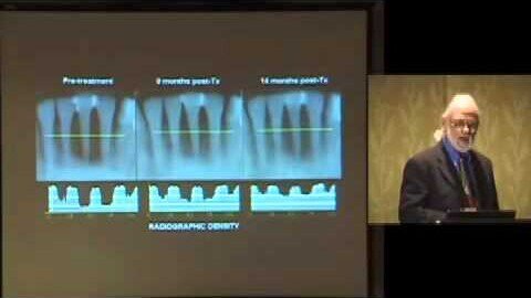 David M. Harris, BS, MS, PhD: The Use of Lasers in Treating Gum Disease IAOMT Chicago 2008